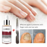 LANBENA Serum for nail restoration - antifungal agent, 15 ml